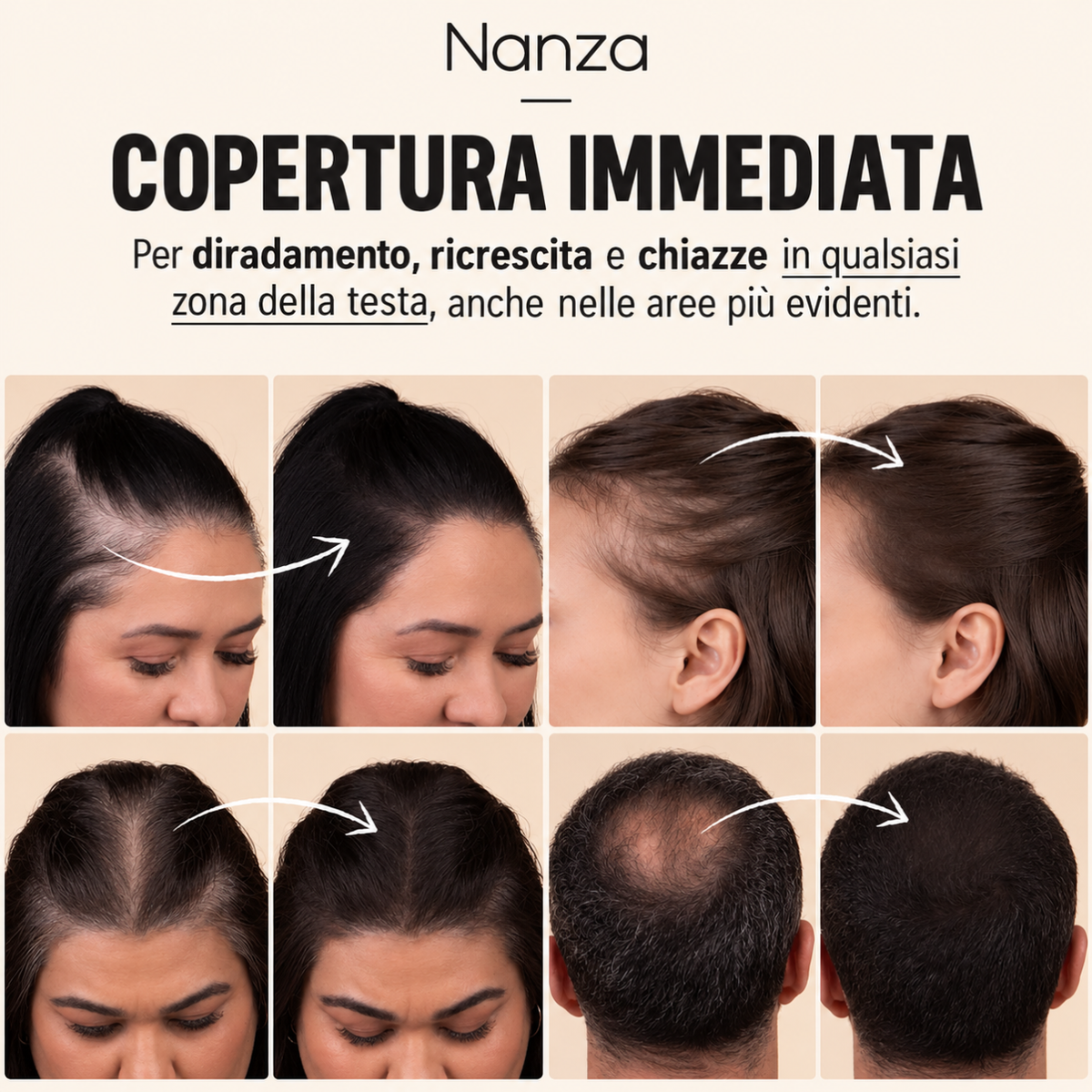 Capelli folti | Capelli pieni in 10 secondi